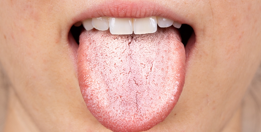 What are the symptoms of Candida overgrowth or other fungal infections?